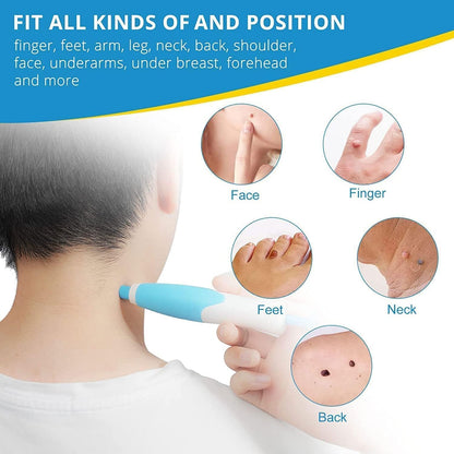 2-in-1 Skin Tag Remover Kit