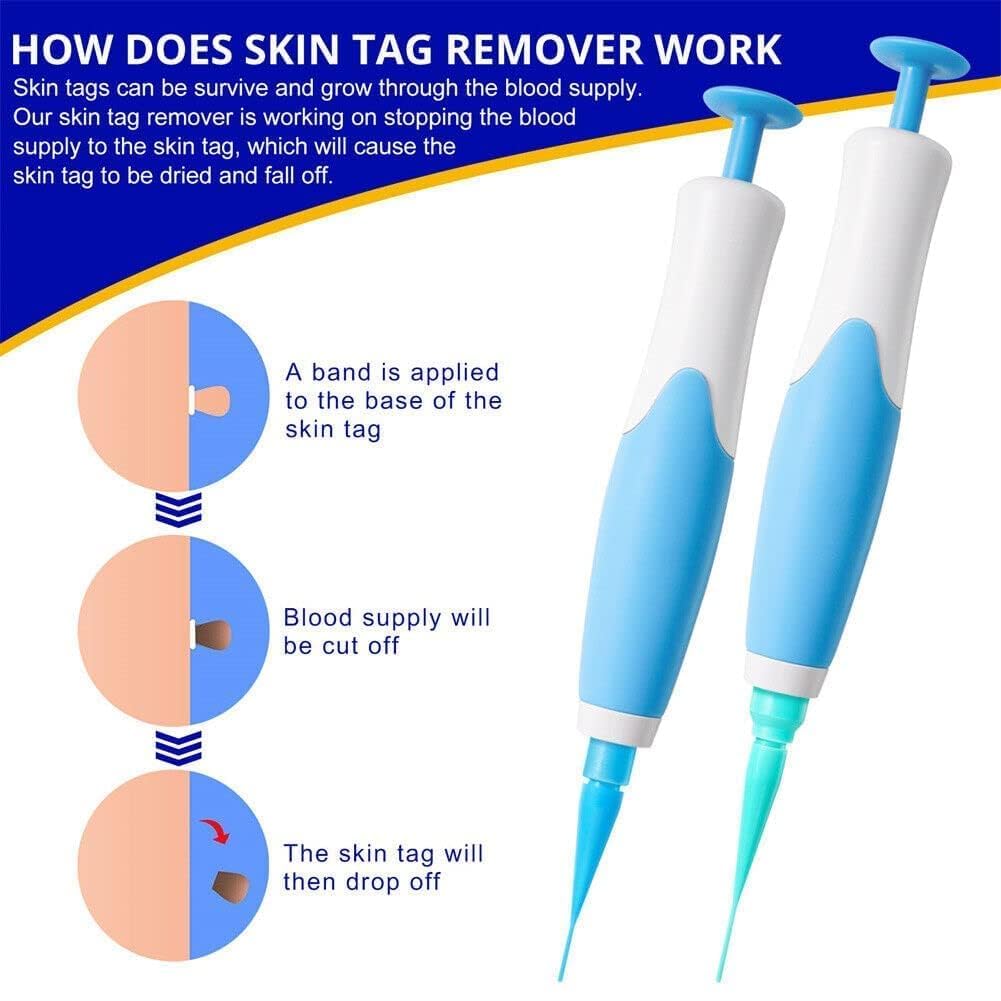 2-in-1 Skin Tag Remover Kit