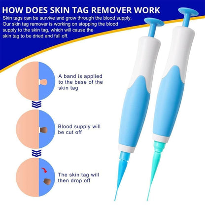 2-in-1 Skin Tag Remover Kit
