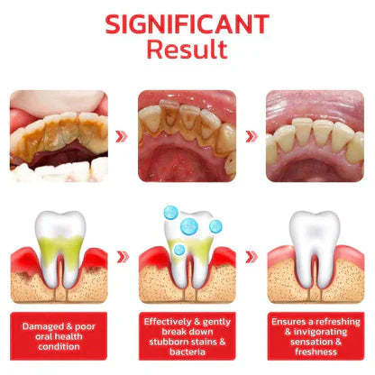 ✨SP-4 Probiotic Brightening & Stain Removing Toothpaste 🦷Pack Of 2